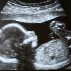 Scherm­afbeelding 2025-05-02 om 14.32.54